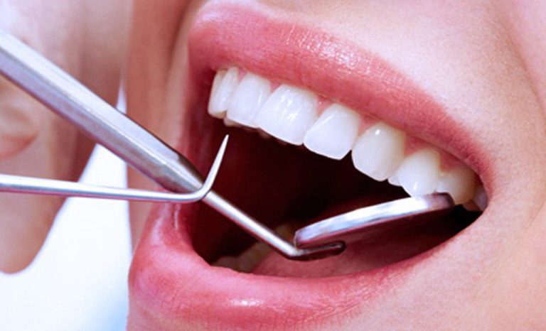 denti sensibili