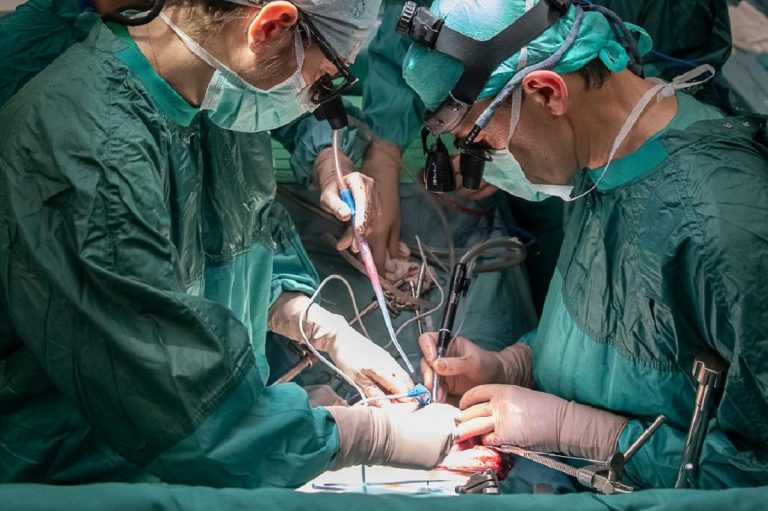 Operazione