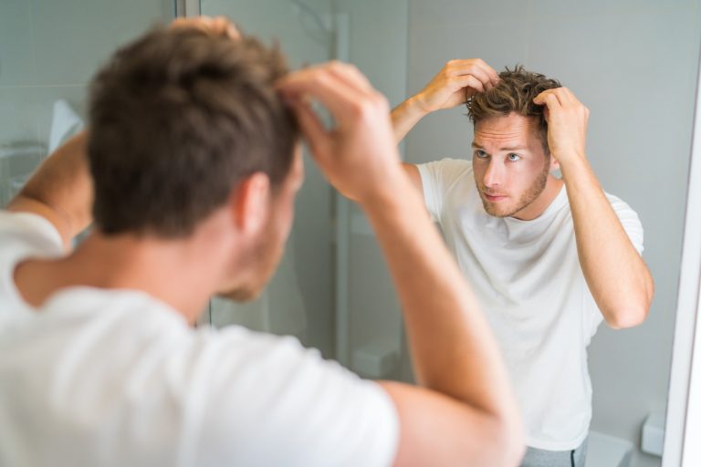 perdita dei capelli