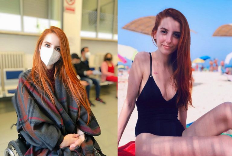 Sindrome di Ehlers-Danlos, l'appello di Sarah Sarritzu