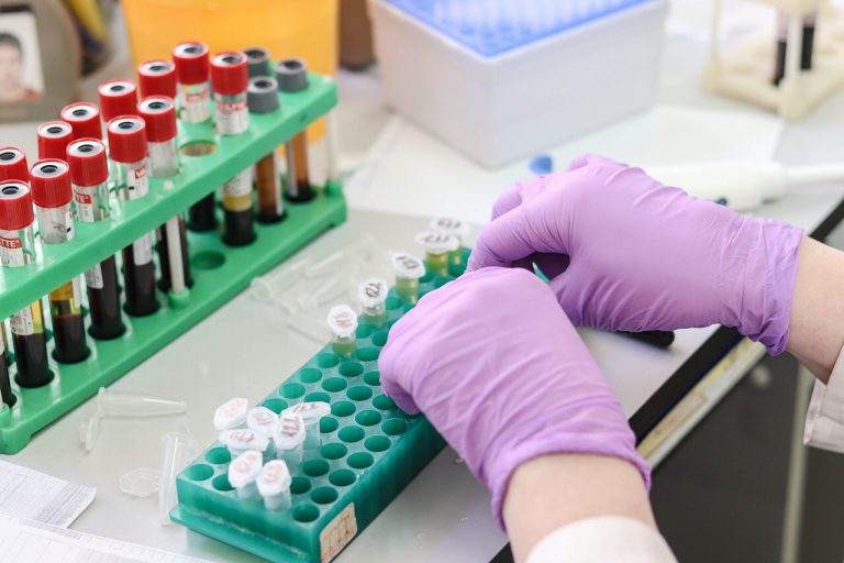 Bilancio Coronavirus 9 luglio 2021