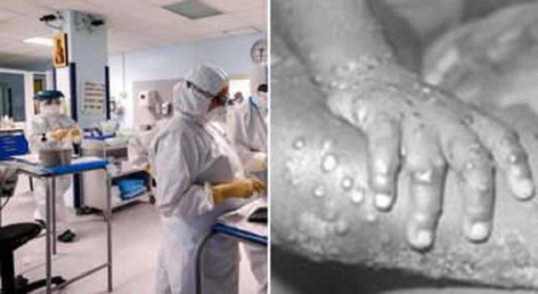Il vaiolo delle scimmie miete la sua prima vittima