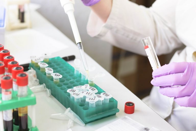 Bilancio Coronavirus 3 agosto 2021