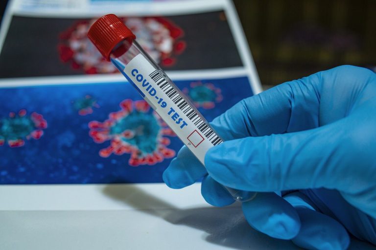 Bilancio Coronavirus 27 lunedì 27 settembre 2021