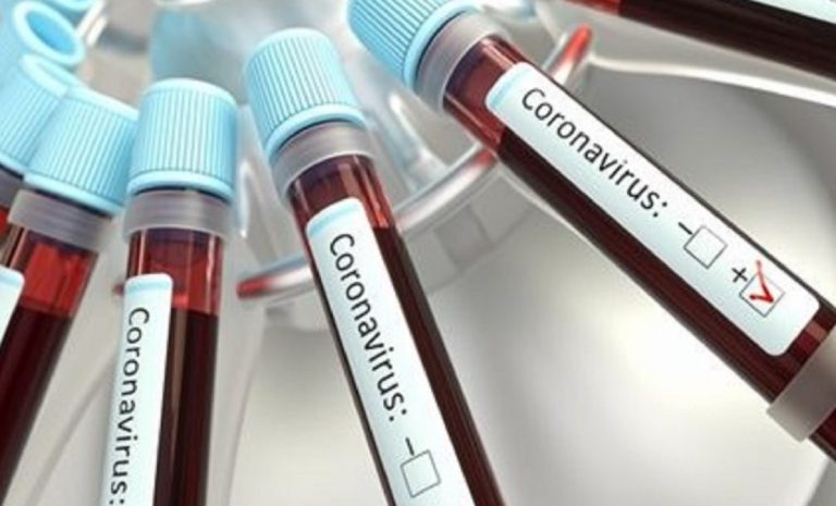 coronavirus bilancio