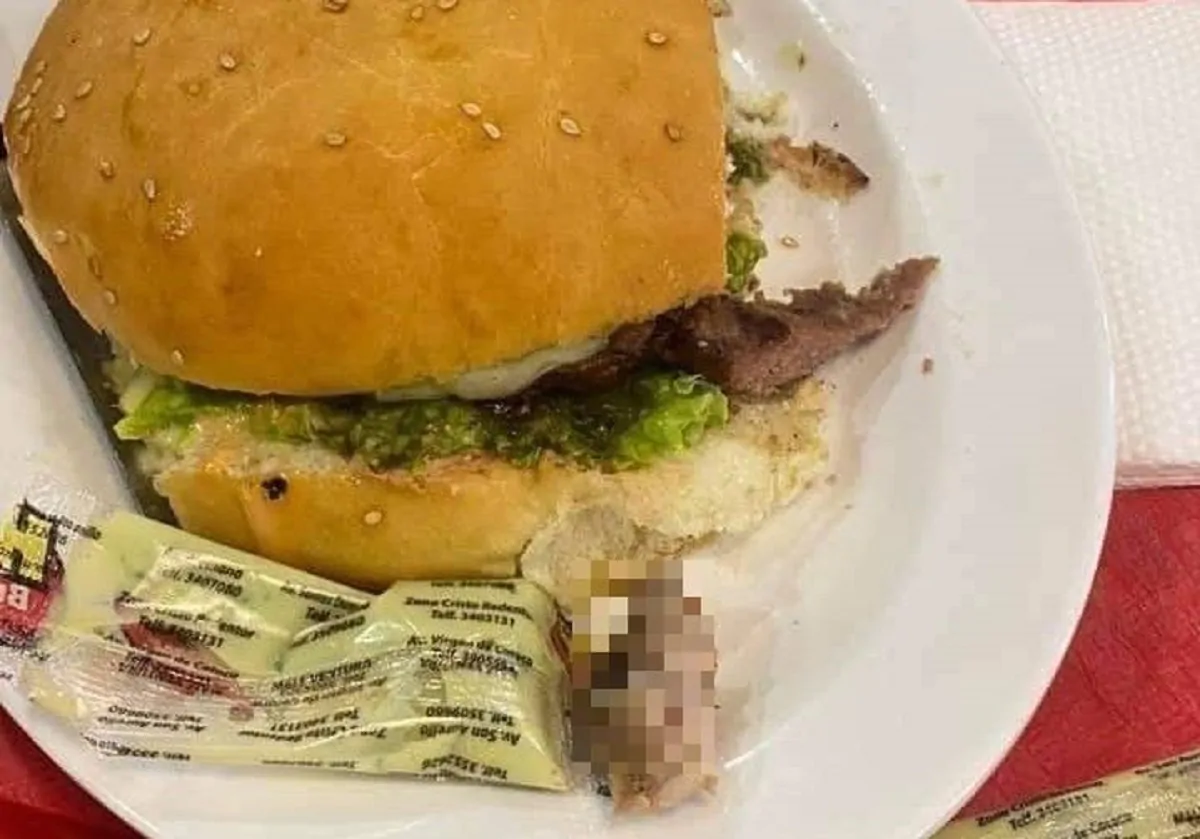 La raccapricciante foto postata su Twitter del dito trovato nell'hamburger