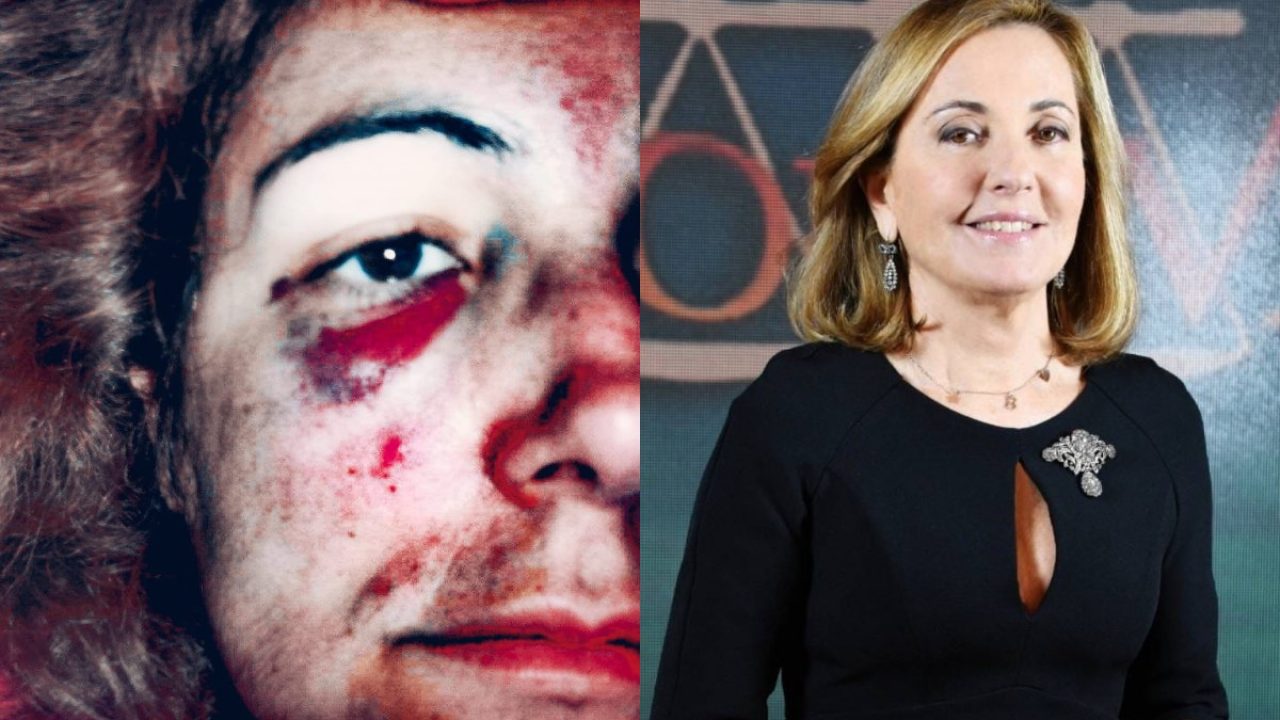 Patrizia Cadau Picchiata Dal Marito Risponde A Barbara Palombelli Nessuna Se La Va A Cercare