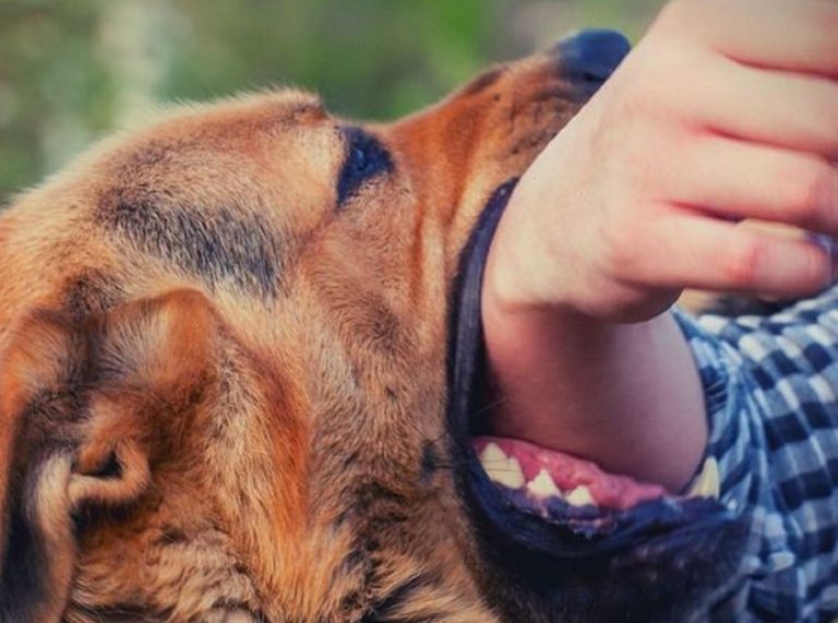 Donna azzannata dai cani della vicina