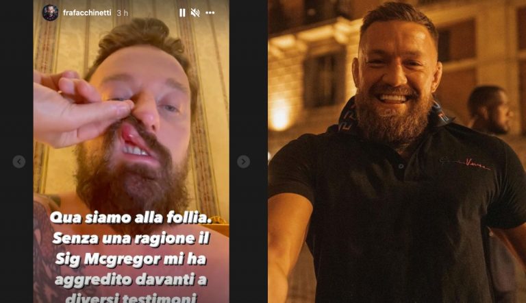 Francesco Facchinetti
