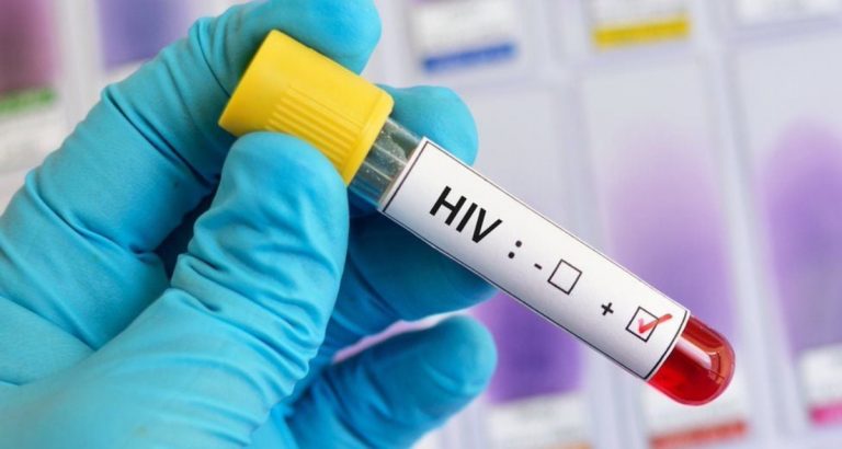 HIV