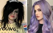 Kelly Osbourne prima e dopo
