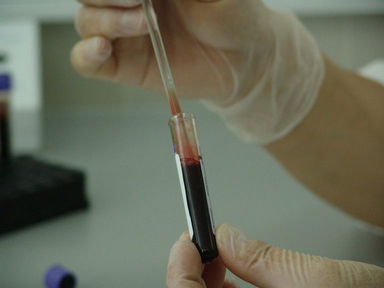 Una donna argentina sconfigge l'Aids "da sé"