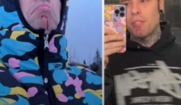 fedez slittino