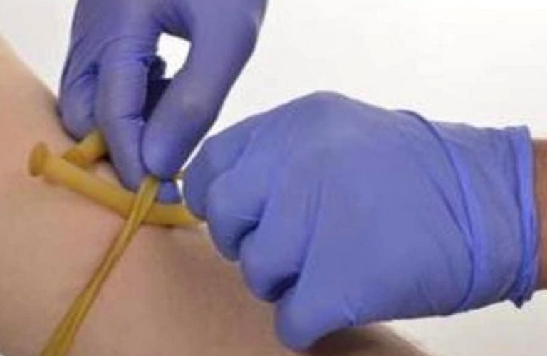 Un "geniale" No Vax ha usato un laccio emostatico per fermare il vaccino anti Covid