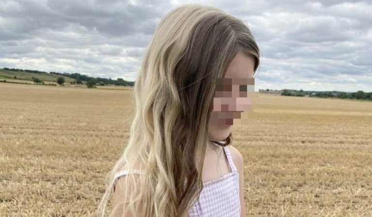 Nasce con capelli e ciglia di colori diversi, bimba affetta da poliosi