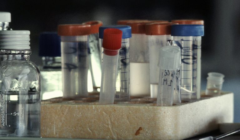 HIV, a New York la prima donna al mondo a essere guarita