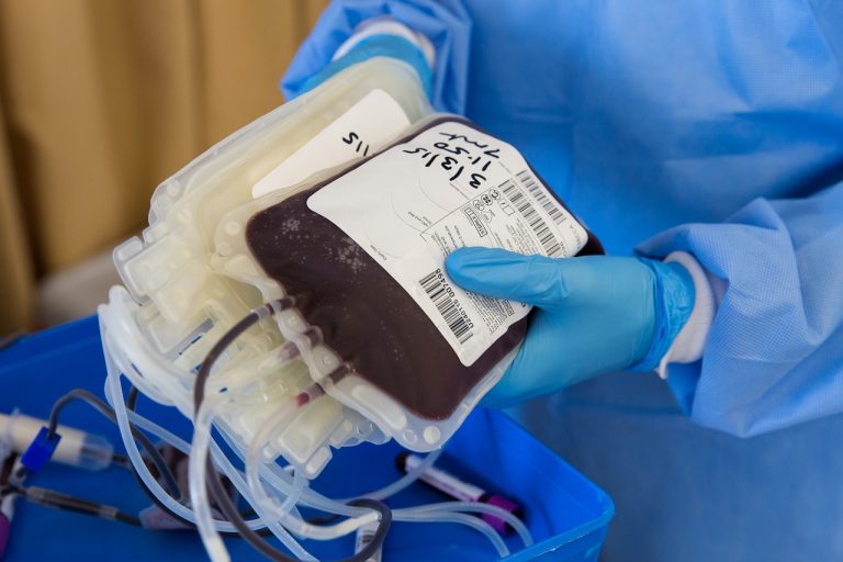 Operato il bimbo per cui i genitori volevano sangue no vax