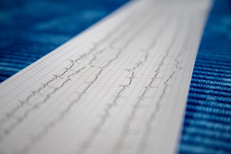 Covid e vulnerabilità cardiaca: c'è uno studio Usa