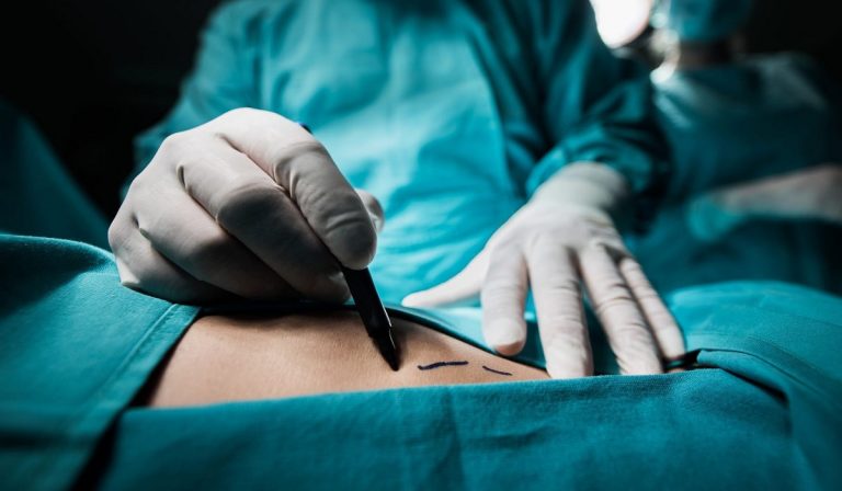 Napoli, Vanessa Cella muore dopo tre interventi estetici