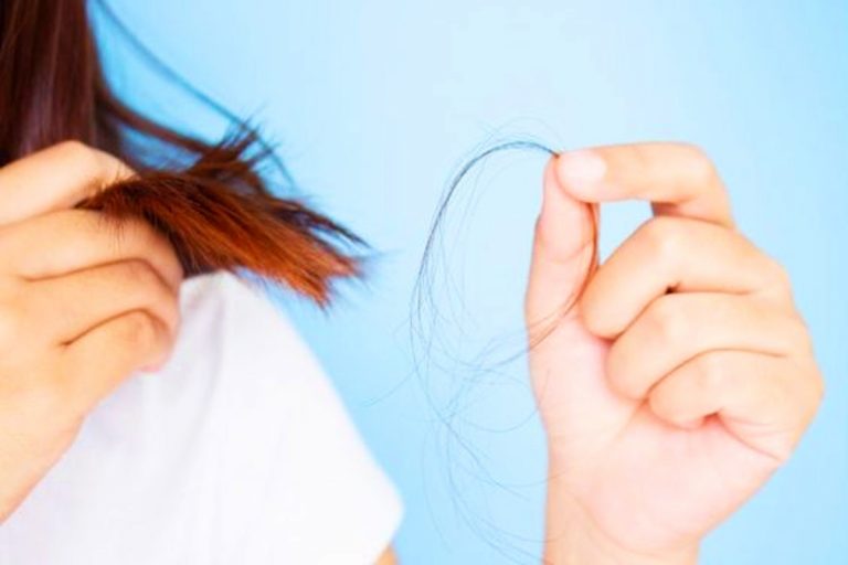capelli persi