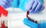 microplastiche sangue umano