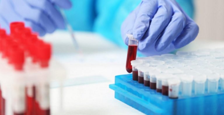 microplastiche sangue umano