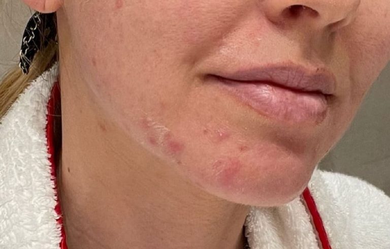 Chiara Ferragni senza filtri su Instagram