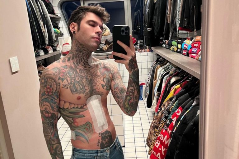 fedez visita di controllo