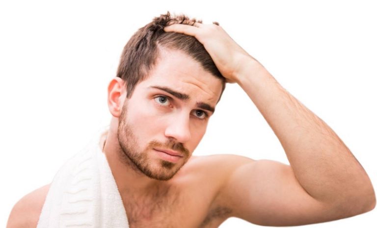 trapianto di capelli