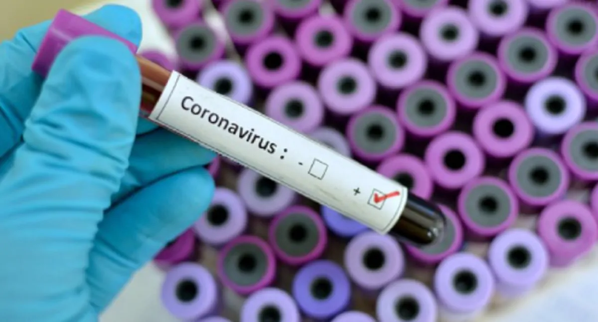 coronavirus bilancio