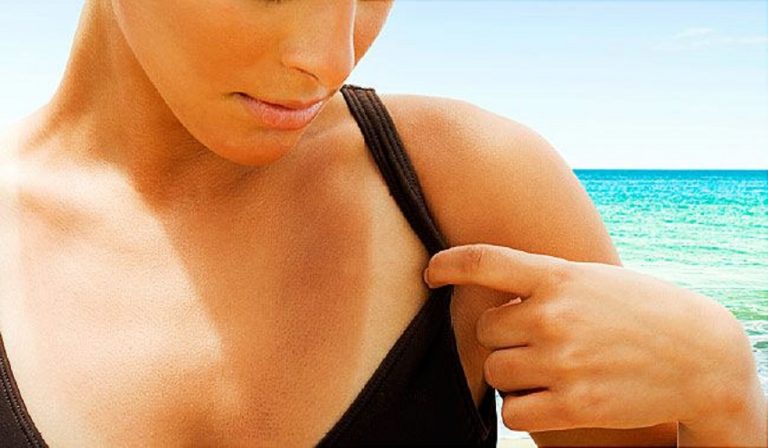 Abbronzarsi con lo spray nasale? La nuova trovata inglese presenta diversi rischi