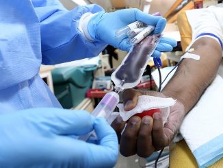 Cosa dice il ministero sulle donazioni di sangue in ordine al monkeypox