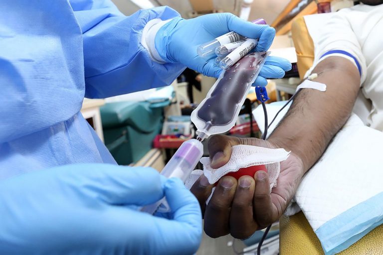 Cosa dice il ministero sulle donazioni di sangue in ordine al monkeypox