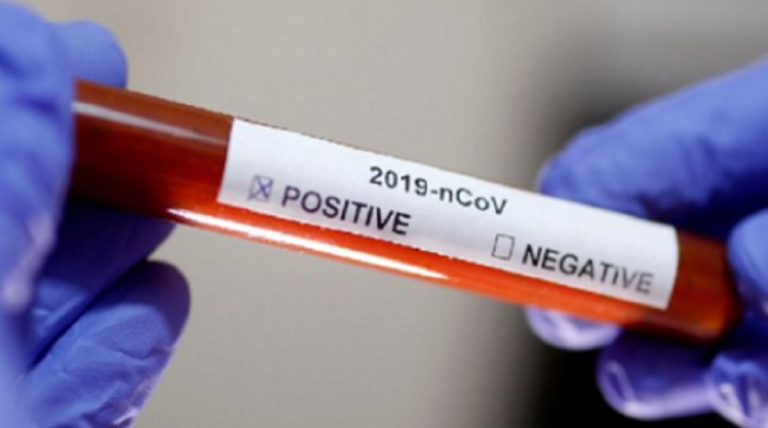 coronavirus bilancio