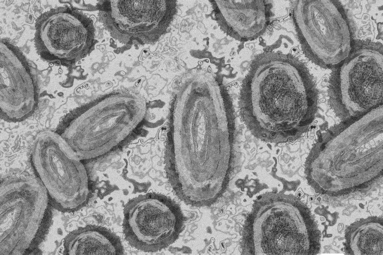 Un caso di monkeypox anche a Verona
