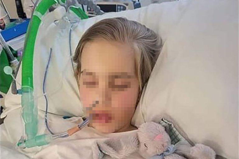 Archie in coma