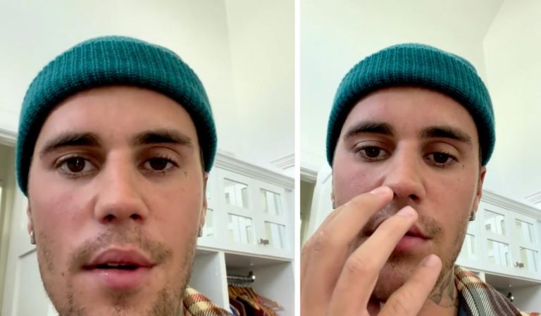 Justin Bieber Ramsey Hunt