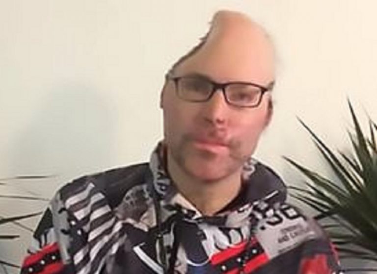 Niko Brennet