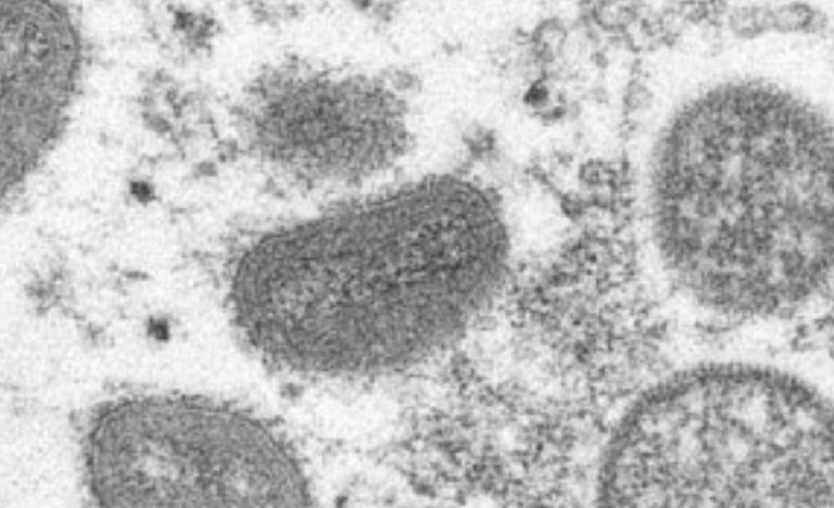 L'esperto Ema parla del monkeypox