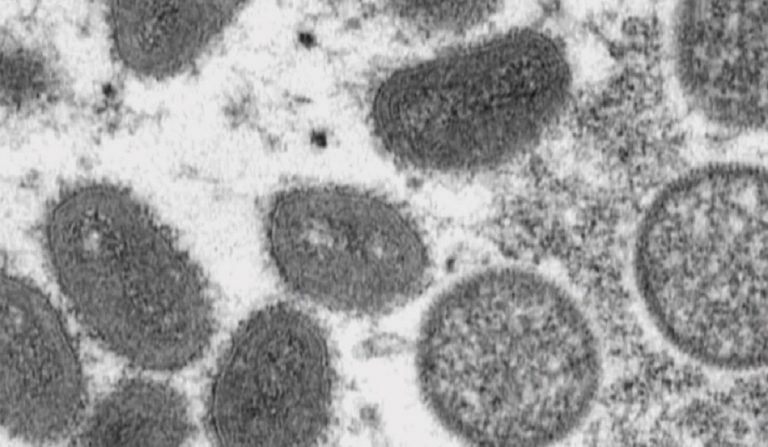 Secondo casi di "monkeypox" in Puglia