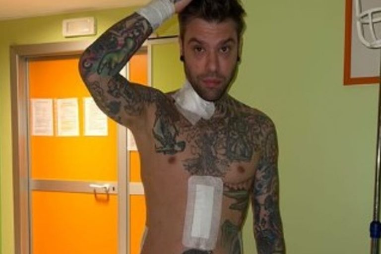 Fedez nuove foto intervento