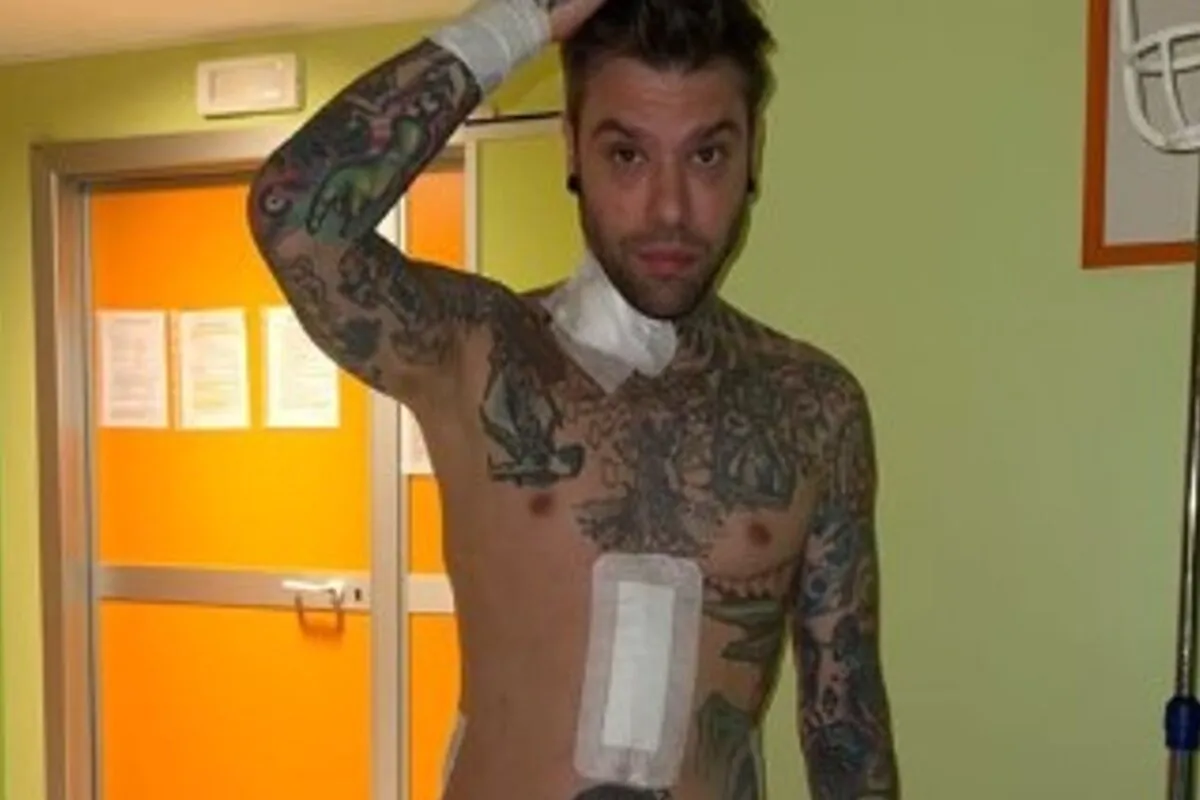 Fedez nuove foto intervento