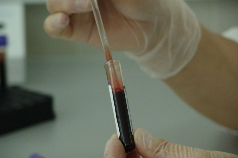 virus vaiolo delle scimmie