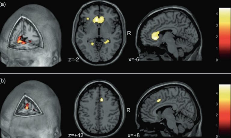 Le scansioni cerebrali del professor Guervain
