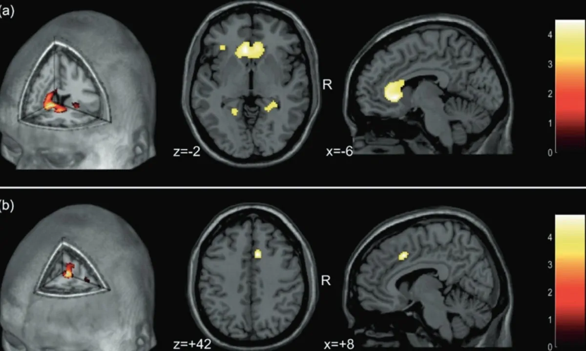 Le scansioni cerebrali del professor Guervain