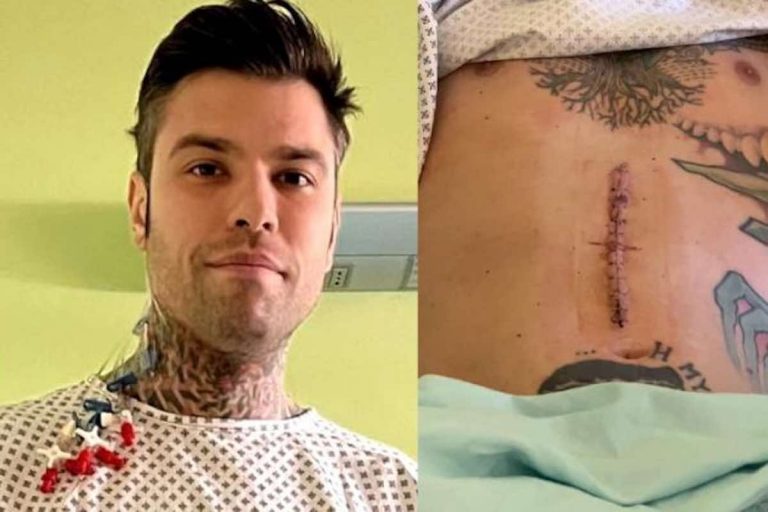 Fedez