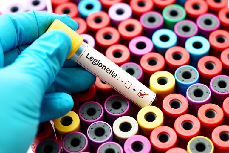 focolaio legionella val seriana