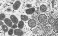 Il virus del monkeypox che assieme ad altri due ha infettato l'uomo
