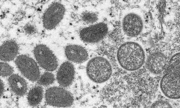 Il virus del monkeypox che assieme ad altri due ha infettato l'uomo