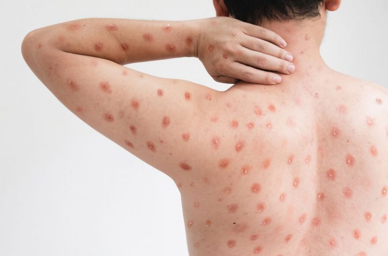 Influenza del pomodoro